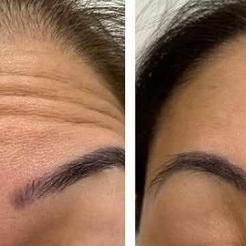 Procedimento no Natalia Garcia Centro de Estética